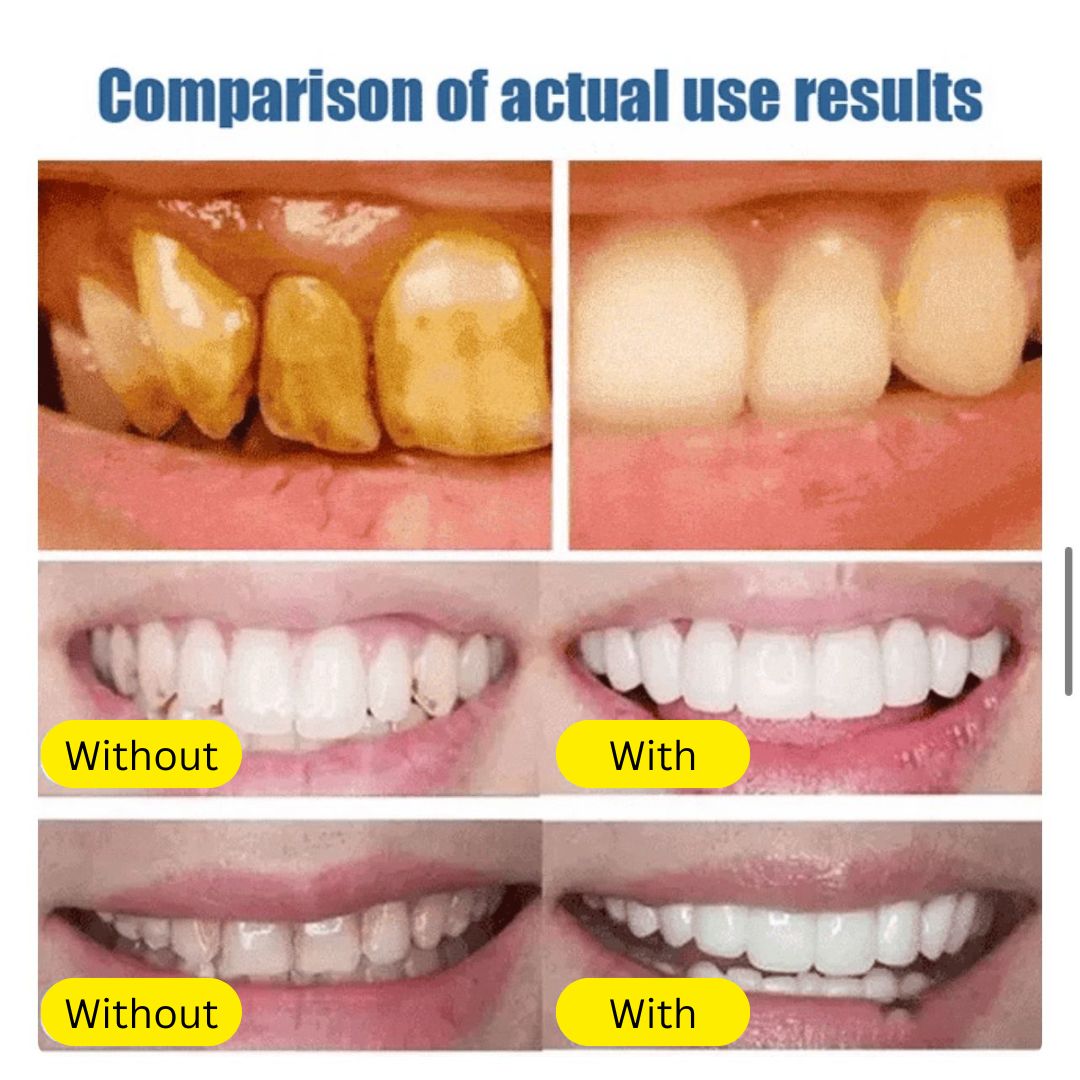 SP4 Ultra Whitening Probiotic Toothpaste