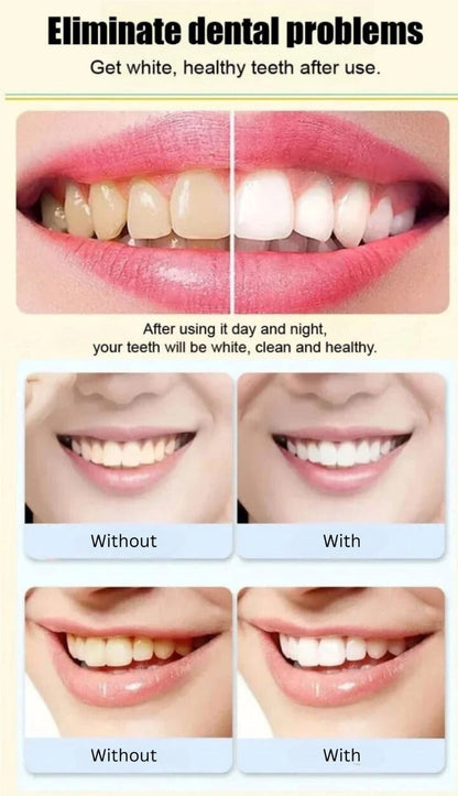 SP4 Ultra Whitening Probiotic Toothpaste